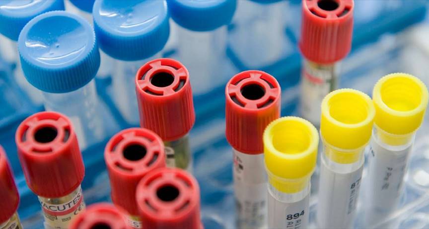 Laboratorio di analisi