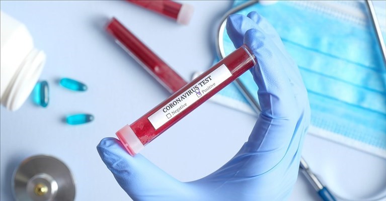 Coronavirus