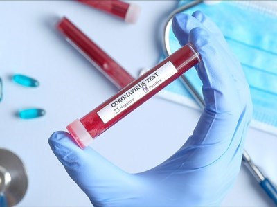 Coronavirus