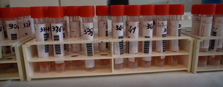 Laboratorio Covid
