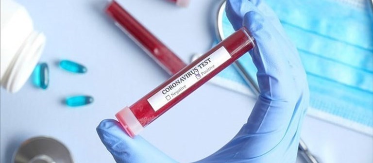 Coronavirus