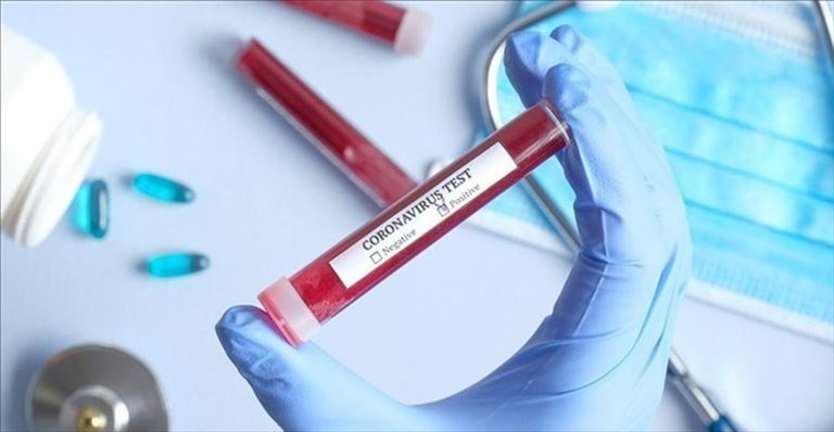 Coronavirus