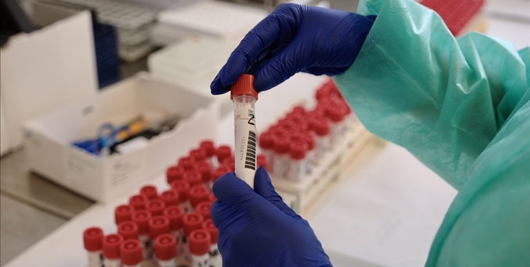 Coronavirus