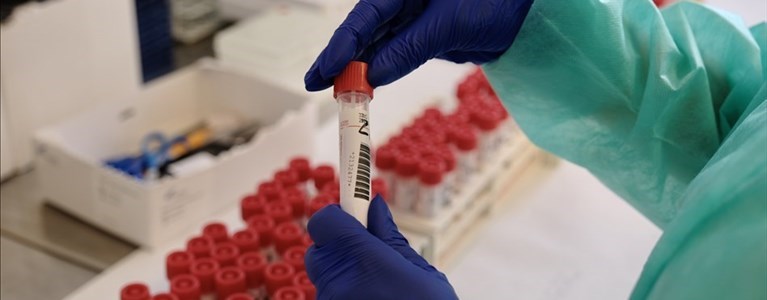 Laboratorio Coronavirus