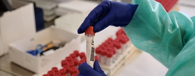 Laboratorio Covid del Di Venere a Bari - Coronavirus