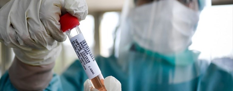 Coronavirus