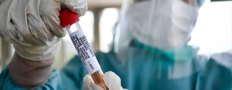 Coronavirus
