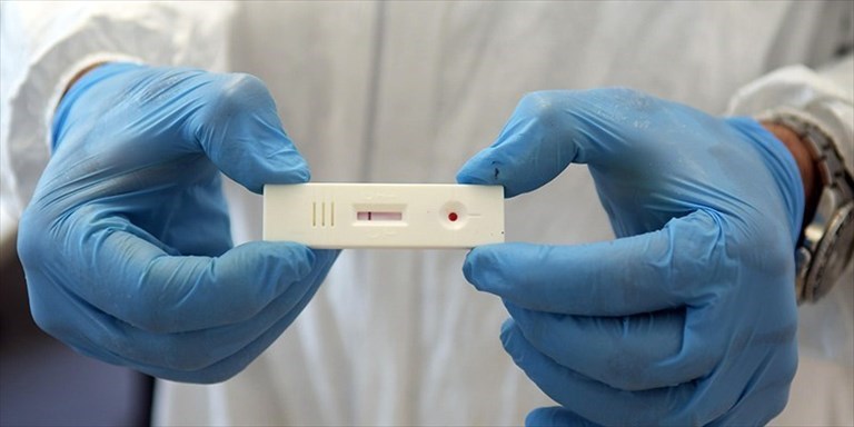 test antigenico