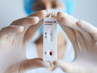 test antigenici rapidi
