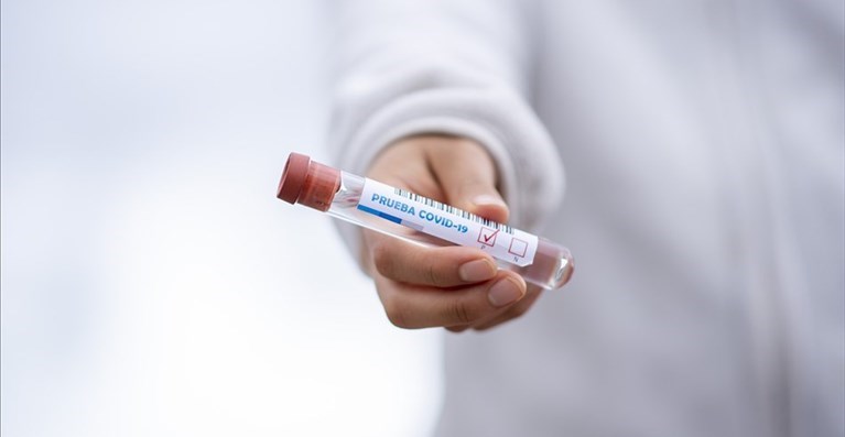 Coronavirus: 1.155 nuovi casi positivi ma calano i decessi