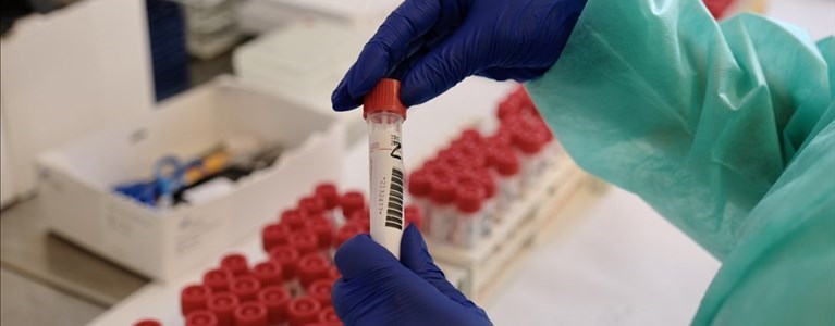 Laboratorio Covid