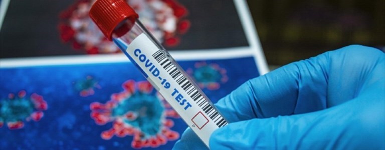 Coronavirus