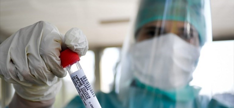 Coronavirus