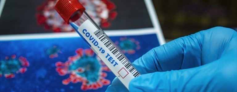 Coronavirus