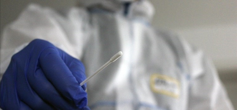 Coronavirus test