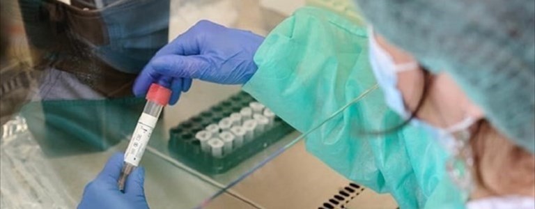 Coronavirus