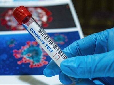 Coronavirus