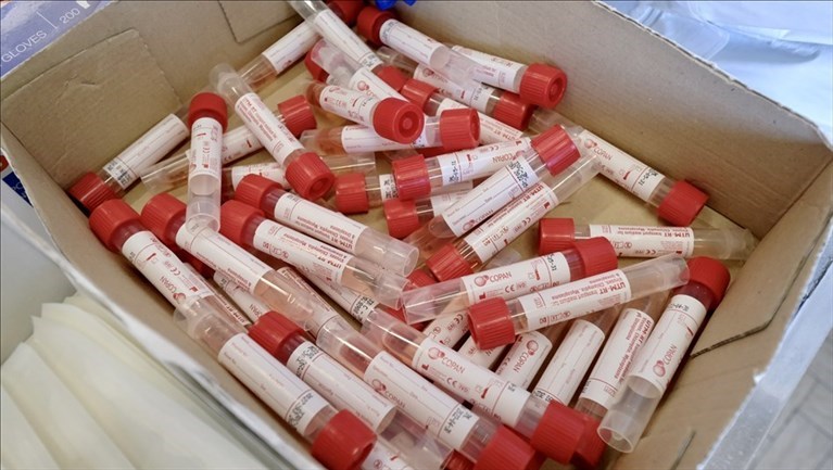 Laboratorio Covid al Di Venere di Bari: la macchina da 1000 tamponi
