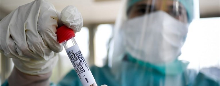 Coronavirus