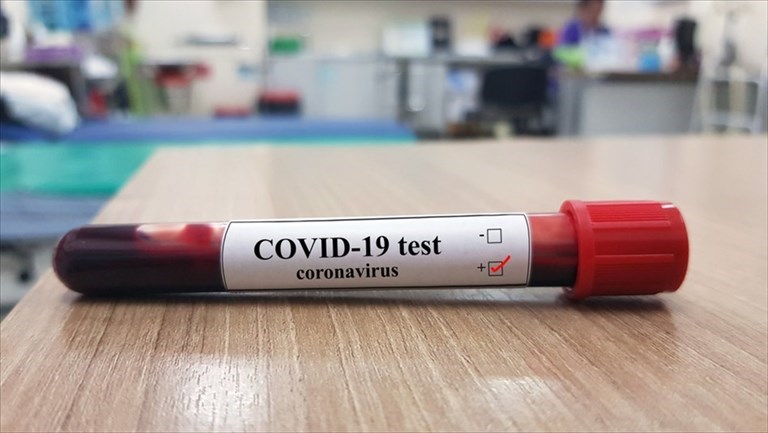 Covid Test