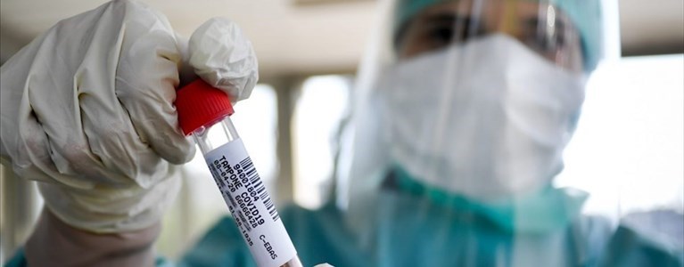 Coronavirus