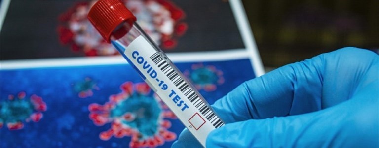 Coronavirus
