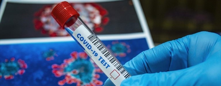 Coronavirus
