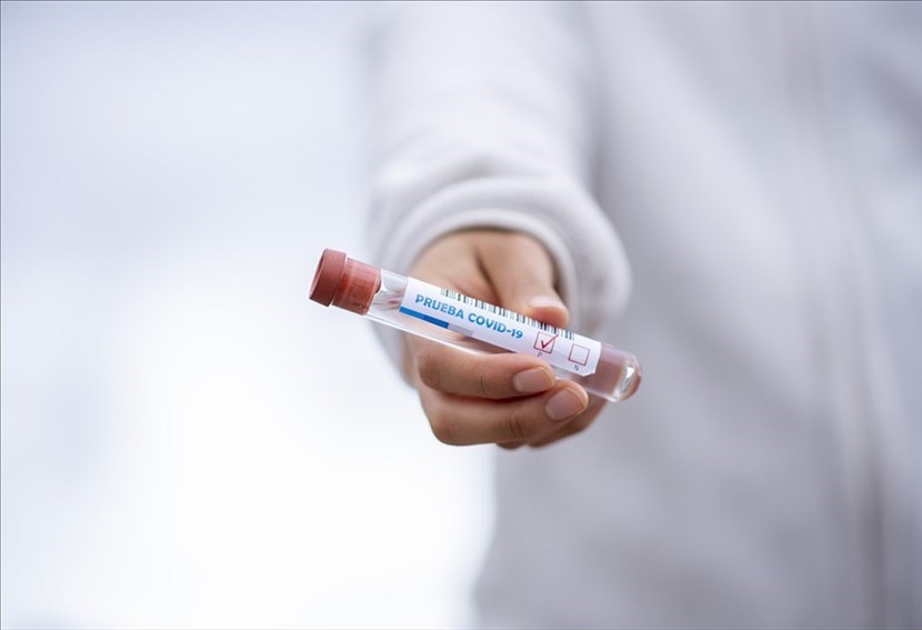 Coronavirus: 1.155 nuovi casi positivi ma calano i decessi