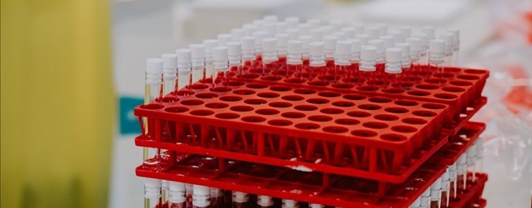 Laboratorio Covid test