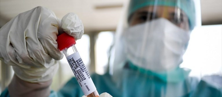 Coronavirus