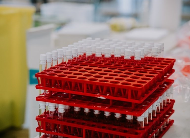 Laboratorio Covid test