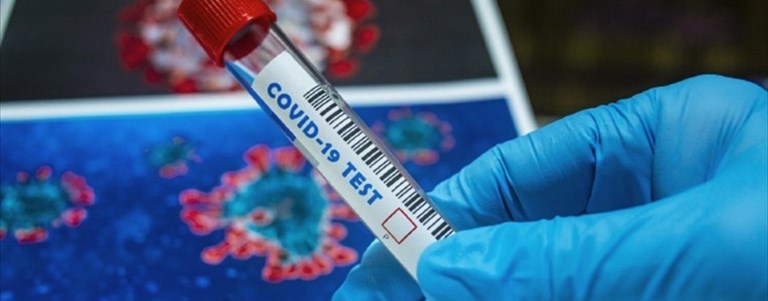 Coronavirus