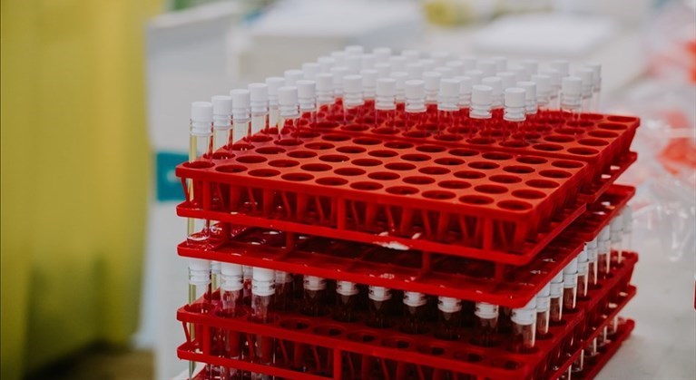 Laboratorio Covid test