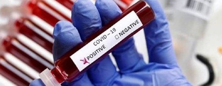 Coronavirus