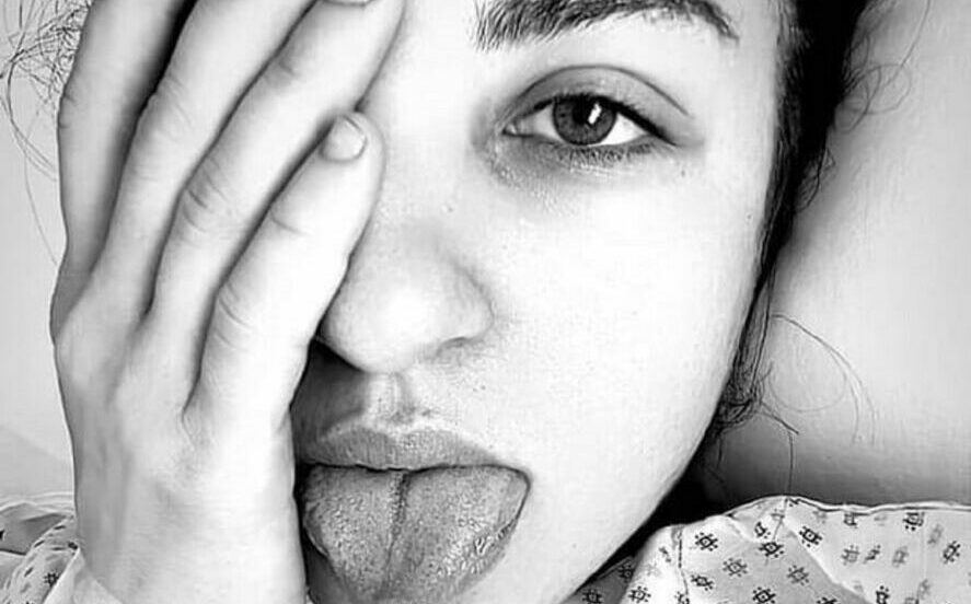 Dal letto dell’ospedale la trapezista manda il selfie: «Sto bene»