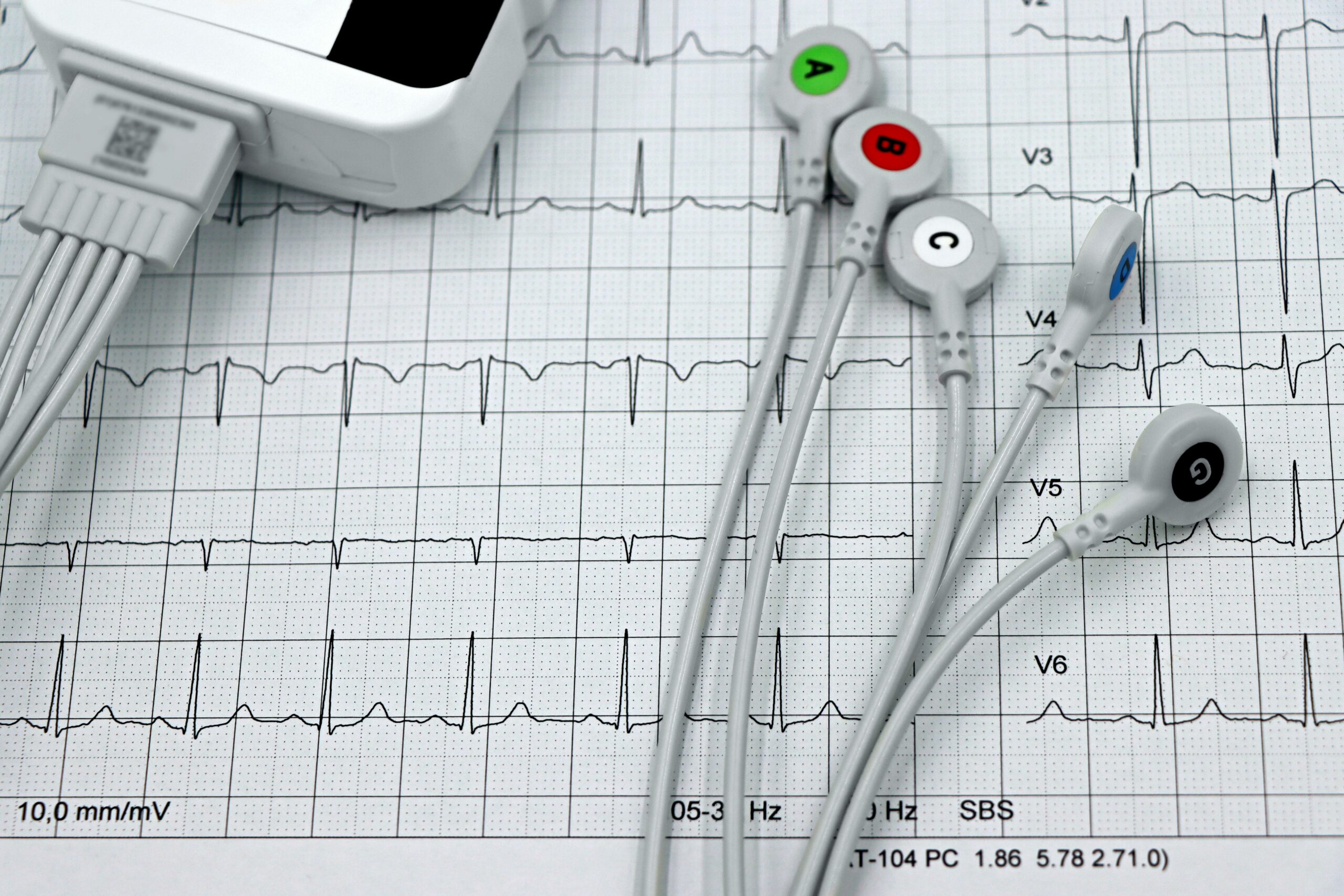 Esami cardiologici in farmacia, oltre 10mila in sei settimane