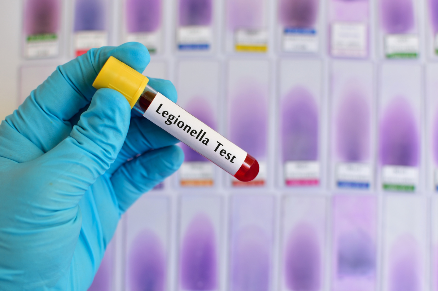 Legionella, campagna di prevenzione ASL Bari per circa 1.400 strutture tra RSA, alberghi e B&B