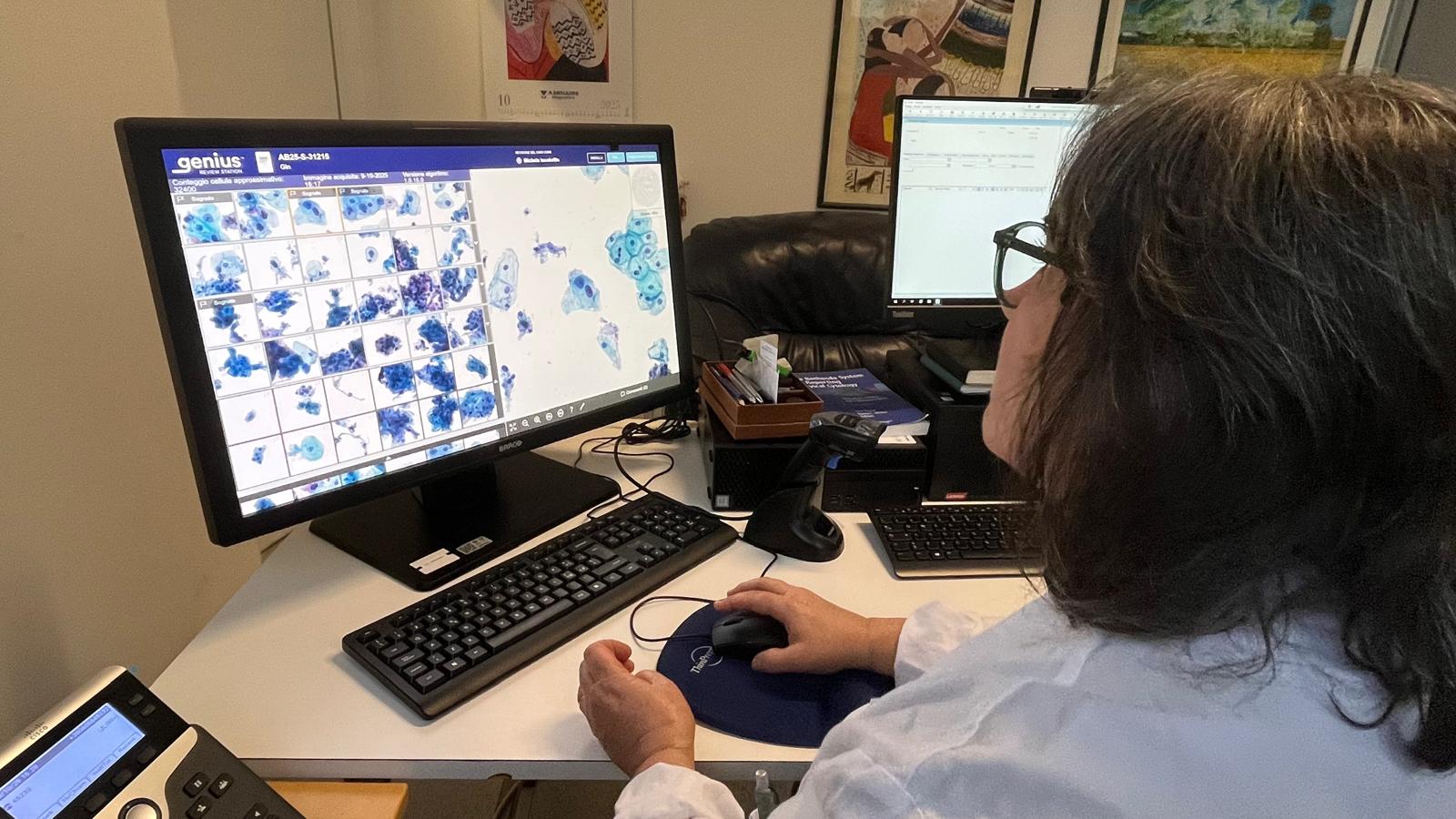 Tumore collo dell’utero, con l’IA più qualità e velocità nelle diagnosi: la Asl Bari introduce la diagnostica citologica digitale